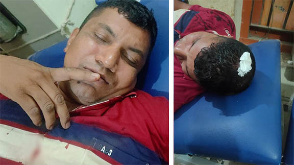 দুই পুলিশকে হাতুড়িপেটা করলো আসামি