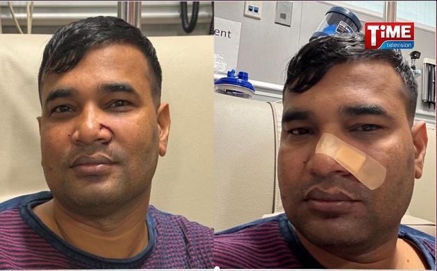 নিউইয়র্কে আবারো সাবওয়ে ট্রেনে দূর্বৃত্তের হামলার শিকার বাংলাদেশি যুবক